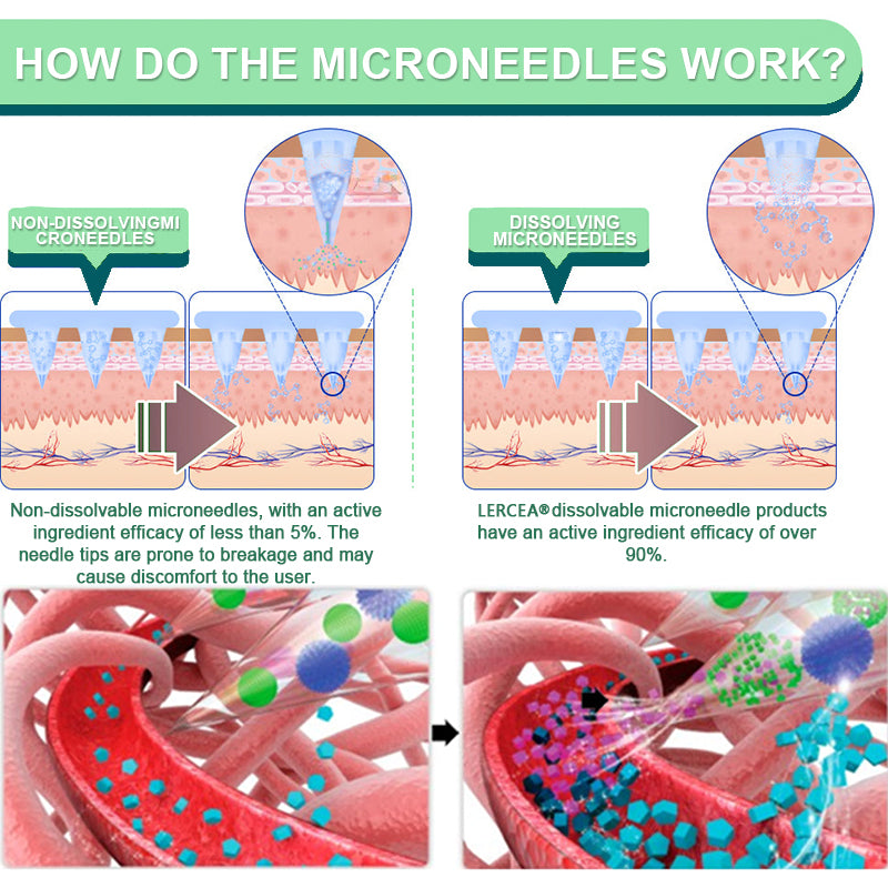 【Last Day Promotion 60% OFF🏅】Lercea® NIDDK-Tirzepatide Slimming & Health NANO MICRONEEDLE PATCH🇳🇿 (Zero Pain, 24/7 Release | Lose 9.07 kg FAST | 90% Sugar Reduction |)🎁
