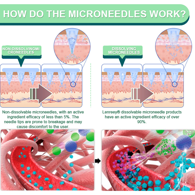 【Last Day Promotion 60% OFF💖】Lercea® NIDDK-Tirzepatide Slimming & Health NANO MICRONEEDLE PATCH🇳🇿 (Zero Pain, 24/7 Release | Lose 9.07 kg FAST | 90% Sugar Reduction |)🎁