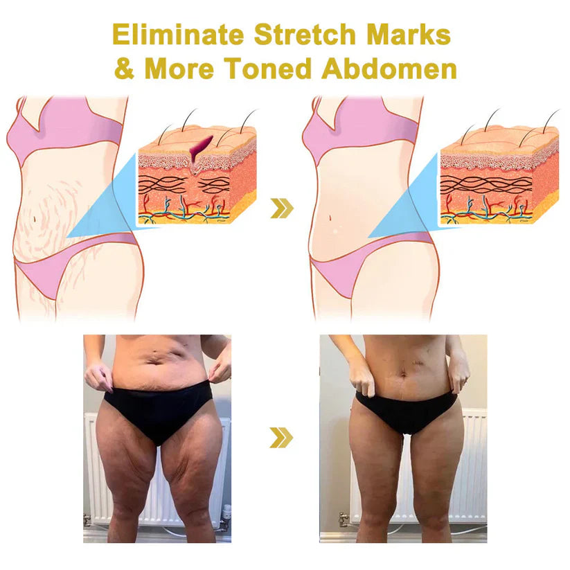 🌹𝐋𝐚𝐬𝐭 𝐃𝐚𝐲 𝐃𝐢𝐬𝐜𝐨𝐮𝐧𝐭: 87% 𝐎𝐅𝐅🌸𝐅𝐮𝐛𝐬𝐭𝐚® 𝐀𝐝𝐯𝐚𝐧𝐜𝐞𝐝 𝐅𝐢𝐫𝐦𝐢𝐧𝐠 & 𝐖𝐫𝐢𝐧𝐤𝐥𝐞-𝐑𝐞𝐝𝐮𝐜𝐢𝐧𝐠 𝐂𝐫𝐞𝐚𝐦: Restore Skin Elasticity⭐