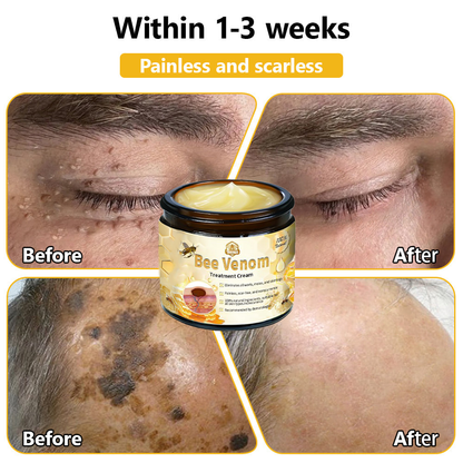 BSWELL™ Bee Venom Skin Treatment Cream (AAD Recommended)🎉🎉