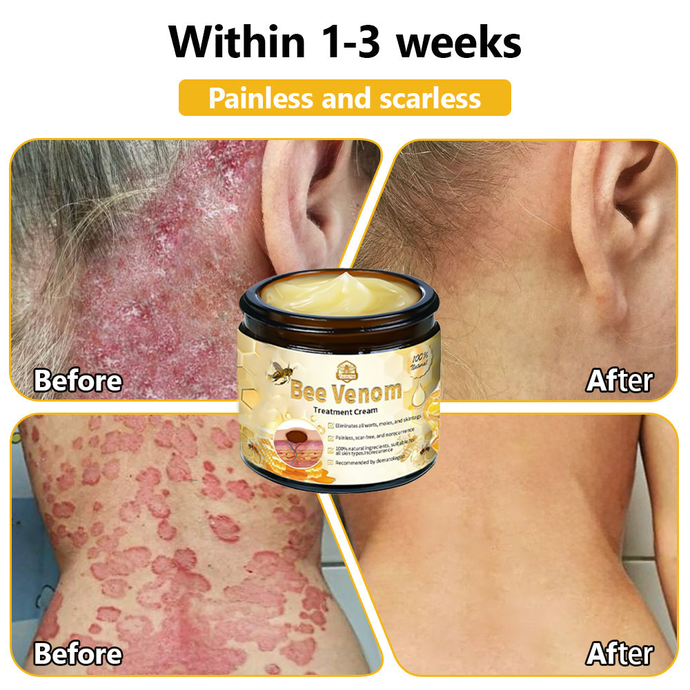 BSWELL™ Bee Venom Skin Treatment Cream (AAD Recommended)🎉🎉