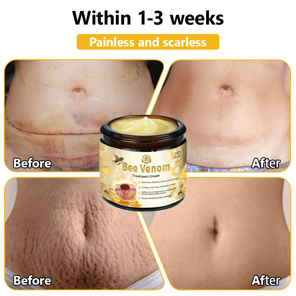 BSWELL™ Bee Venom Skin Treatment Cream (AAD Recommended)🎉🎉
