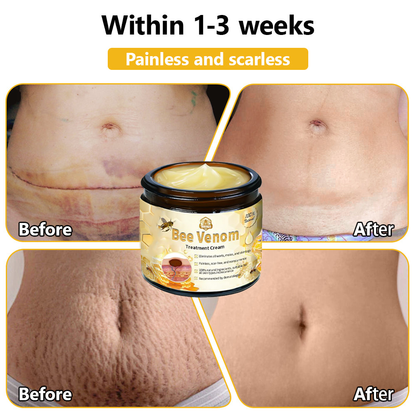 BSWELL™ Bee Venom Skin Treatment Cream (AAD Recommended)🎉🎉
