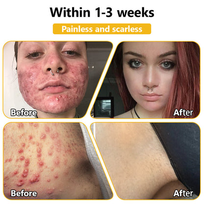BSWELL™ Bee Venom Skin Treatment Cream (AAD Recommended)🎉🎉